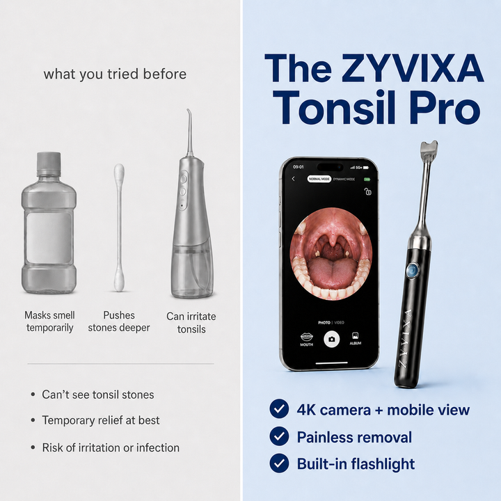 Tonsil Pro 4