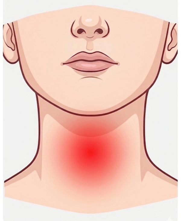 Sore Throat